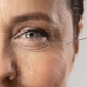 elder-woman-using-injection-her-eye-wrinkles